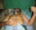 2nd case Post Op 